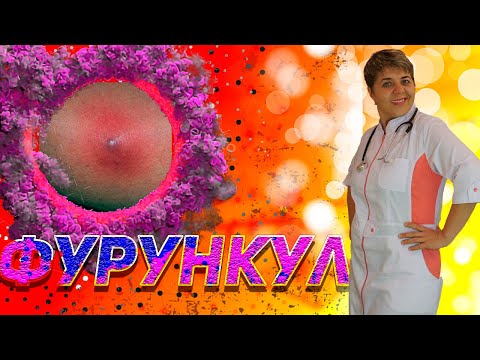 Видео: 💊 ФУРУНКУЛ 🔴 Как лечить фурункулы в домашних условиях (чирий)  МЕДИЦИНА ЗДОРОВЬЕ Разумная медицина