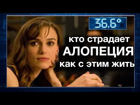 Видео: Женская и мужская алопеция. Передача 36.6 Екатеринбург ТВ