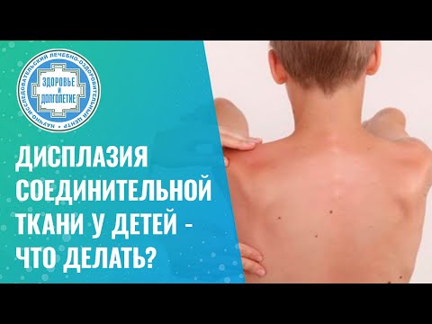 Видео: 🤷‍♀️  Дисплазия соединительной ткани у детей - что делать?