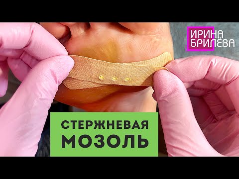 Видео: Убираем СТЕРЖНЕВУЮ МОЗОЛЬ 🌸 Эстетический ПЕДИКЮР 🌸 Ирина Брилёва