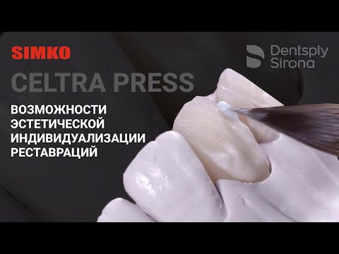 Видео: Стеклокерамика CELTRA PRESS | Возможности эстетической индивидуализации реставраций