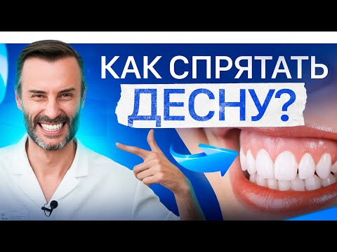 Видео: Десневая улыбка. Кто поможет – ортодонт, хирург или косметолог?
