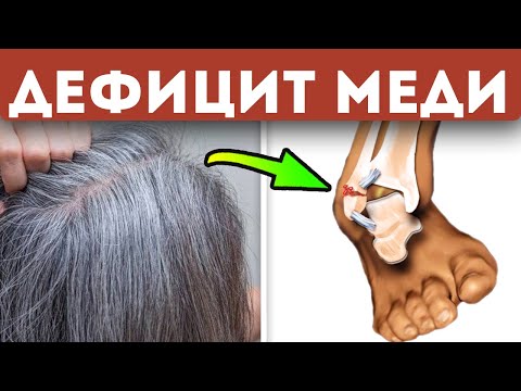 Видео: Секреты раскрыты! Вот какие последствия дефицита меди, и как его быстро восполнить
