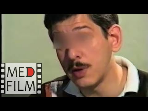 Видео: Слабоумие. Социальная сфера. Подбор лекарств. Менингоэнцефалит в детстве © Dementia, social life