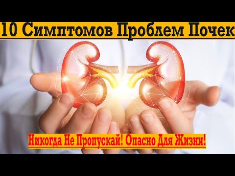 Видео: 10 Симптомов Проблем Почек! Опасно! Никогда не пропускай!
