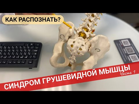 Видео: БОЛИТ В ЯГОДИЦЕ И ОТДАЕТ В НОГУ. Синдром грушевидной мышцы. (Часть 1)