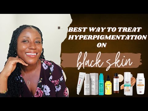 Видео: Как избавиться от гиперпигментации на темной коже || Как избавиться от гиперпигментации