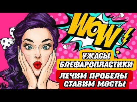 Видео: МЕЖРЕСНИЧНЫЕ  ПРОБЕЛЫ НАРАЩИВАНИЕ РЕСНИЦ , МЕГА ОБЪЁМ ЖЕЛАНИЕ КЛИЕНТА