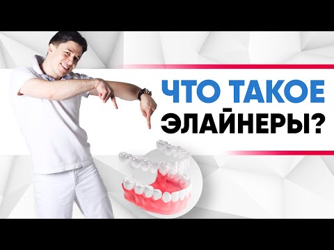 Видео: Элайнеры - это ортодонтические прозрачные каппы для исправления прикуса [ альтернатива брекетам].
