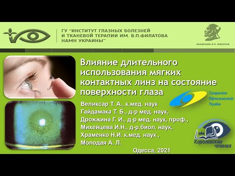 Видео: Влияние длительного использования мягких контактных линз на состояние поверхности глаза