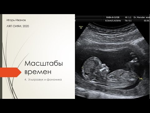 Видео: И.Иванов Лекция 4. "Ультразвук и фононика" / I.Ivanov Lecture 4. "Ultrasound and phononics"