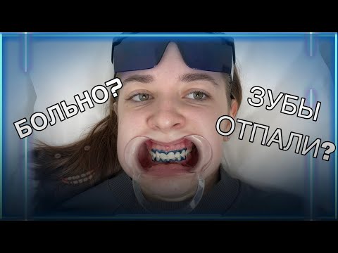 Видео: Я ОТБЕЛИЛА ЗУБЫ... и вот что из этого получилось