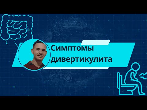 Видео: Симптомы острого дивертикулита