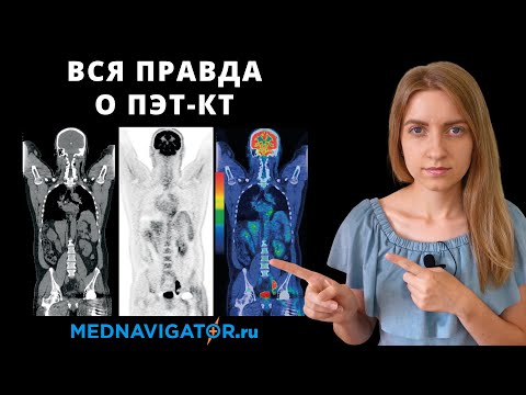 Видео: ПЭТ-КТ - что это такое и как проводится? | ПЭТ-КТ в онкологии и кардиологии | Mednavigator.ru