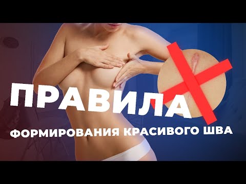 Видео: Секрет красивого шва | Швы после маммопластики | Средства для заживления шва