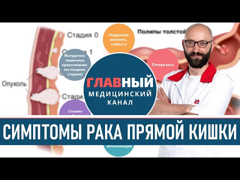 Видео: Симптомы рака прямой кишки на ранних стадиях. Признаки рака кишечника у женщин и мужчин