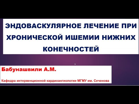 Видео: Эндоваскулярное лечение при хронической ишемии нижних конечностей (Бабунашвили Автандил Михайлович)