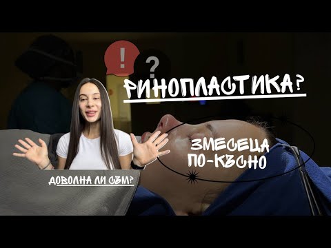 Видео: РИНОПЛАСТИКА В ТУРЦИЯ (ЧАСТ 2)