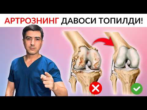 Видео: АРТРОЗ, АРТРИТ, ОСТЕОПОРОЗ, КОКСАРТРОЗ: ЖАРРОҲЛИКСИЗ ДАВОЛАШ МУМКИН! #кинезиология #Артроз #артрит