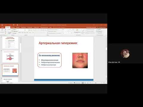 Видео: Нарушения периферического кровообращения