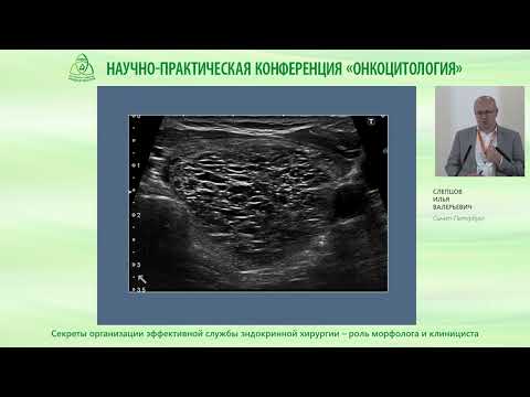 Видео: Секреты организации эффективной службы эндокринной хирургии