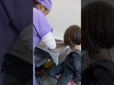 Видео: Как накладывают гипс?