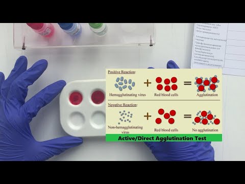 Видео: Бейнесабақ: Қан алу. Қан тобын және резус-факторды анықтау