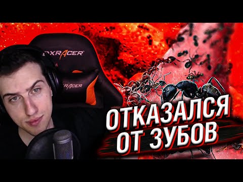 Видео: Hellyeahplay смотрит: Он Отказался от Зубов, Чтобы Отрастить Язык