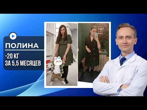 Видео: Полина -20 кг за 5,5 месяцев. Как похудеть без спорта?