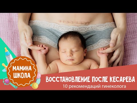 Видео: Восстановление после родов:  кесарево сечение