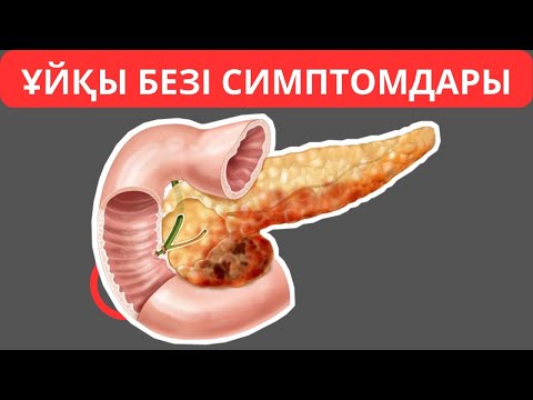 Видео: Ұйқы безі ауруының белгілері, Ұйқы безі симптомдары