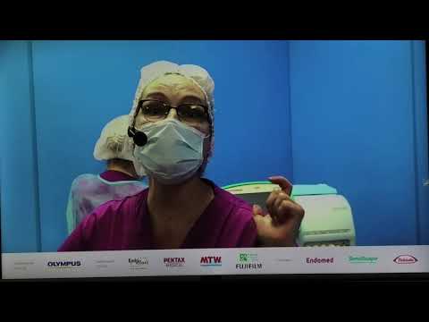 Видео: 47 Live  Табанакова ИА Бронхоскопия Клапанная бронхоблокация кавернозный туберкулез