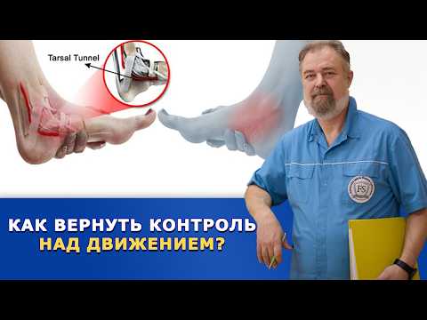Видео: Онемение ушло, а проблемы остались? Как вернуть нормальное движение!