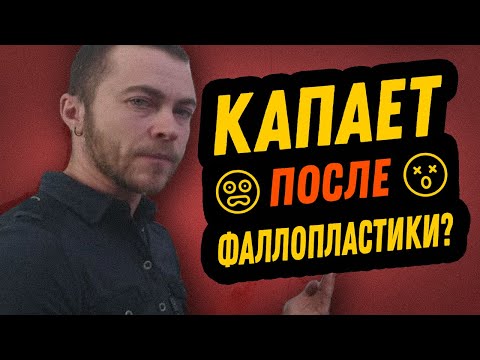 Видео: Подтекает ли после фаллопластики?