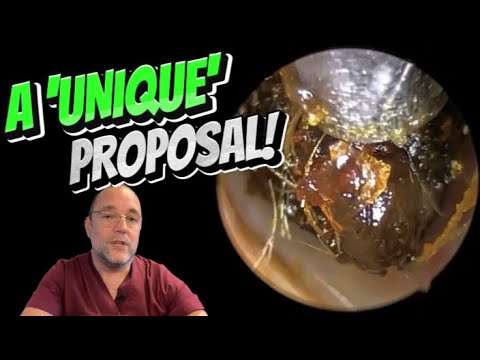 Видео: УНИКАЛЬНОЕ ПРЕДЛОЖЕНИЕ! 298 #ухо #ушнаясера #удалениеушнойсеры #fyp #длявас #asmr #asmrearwax #уд...