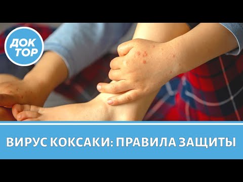 Видео: Где можно заразиться вирусом Коксаки