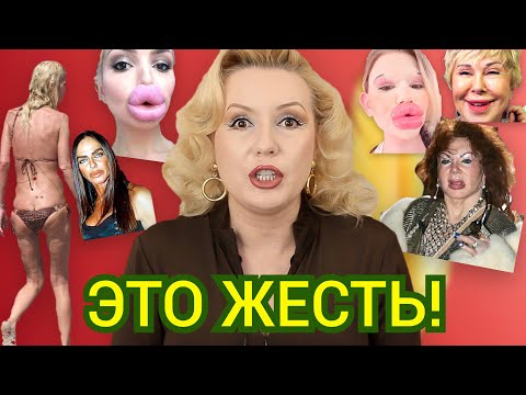 Видео: ПЕРЕБОРЩИВШИЕ С ПЛАСТИКОЙ И ФИЛЛЕРАМИ// ЗАЧЕМ ОНИ ЭТО СДЕЛАЛИ?