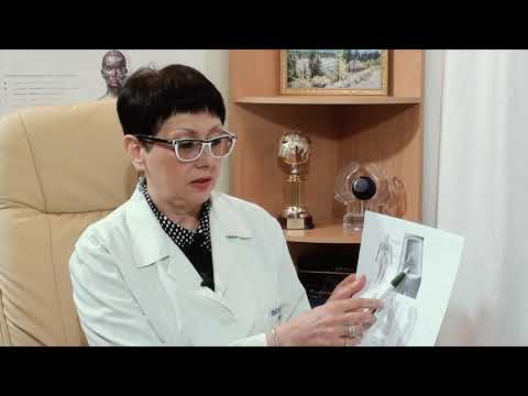 Видео: Варикозное расширение вен. Советы доктора.