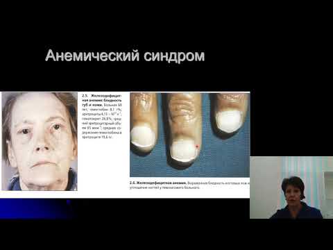 Видео: Факультетская терапия (Внутренние болезни). Анемии