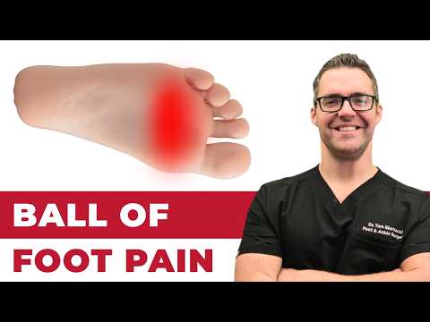 Видео: Боль в подушечках стопы [Домашнее лечение и лечение]