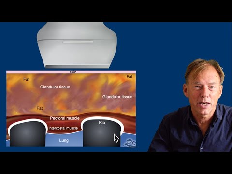 Видео: УЗИ молочной железы - часть 1