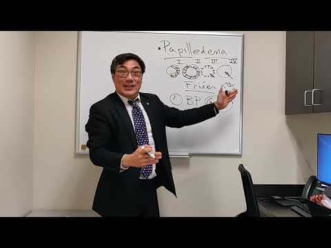 Видео: Отек диска зрительного нерва