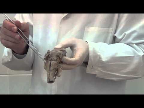 Видео: Гортань. Язык.