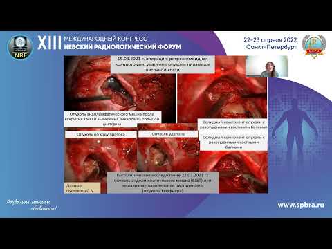 Видео: НАУЧНАЯ СЕКЦИЯ ПО ТЕЗИСАМ «ЛД В ОНКОЛОГИИ И СТОМАТОЛОГИИ»