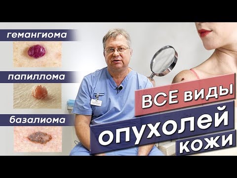 Видео: Онколог Рязань. Рак кожи. Как отличить все виды опухолей?