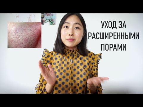 Видео: УХОД ЗА РАСШИРЕННЫМИ ПОРАМИ - ЧТО НУЖНО ДЕЛАТЬ, А ЧТО НЕТ!