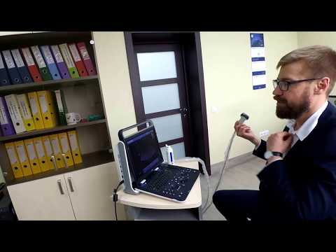 Видео: Обзор УЗИ Chison Sonotouch 60 (Ebit 60)