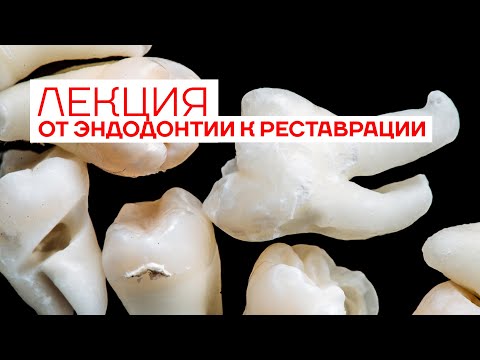 Видео: От Эндодонтии к Реставрации. Лекция Максима Белограда