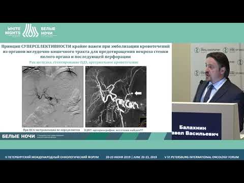 Видео: Роль методов интервенционной радиологии для диагностики и лечения кровотечений из ЖКТ у онко.больных