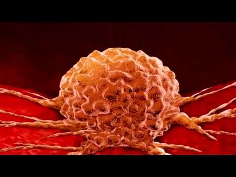 Видео: Барномаи «Пизишки ман» - Пешгирӣ ва ташхиси табобати саратони ғадуди шир